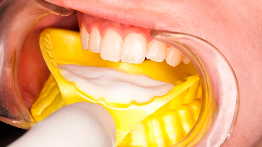 Гель Flairesse DMG - внесение